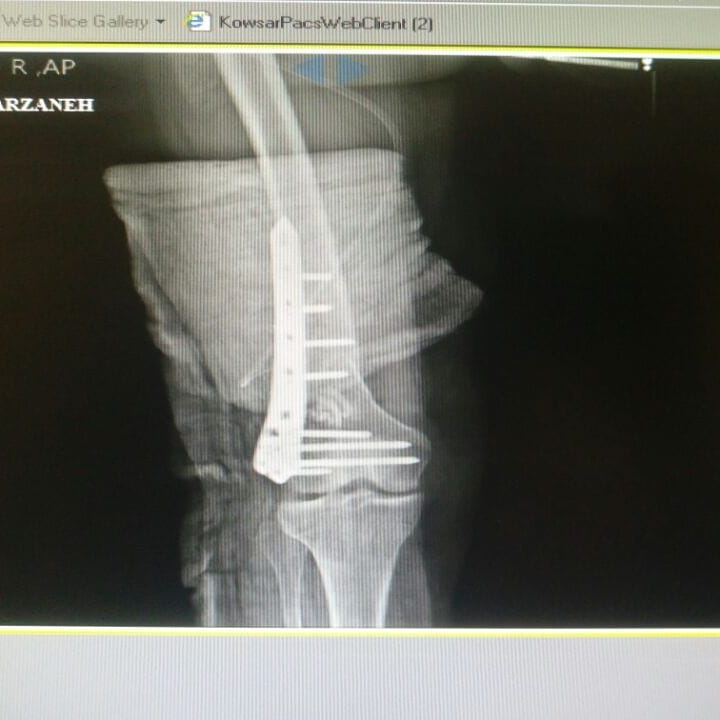 سید میلاد رنجبر - gallery