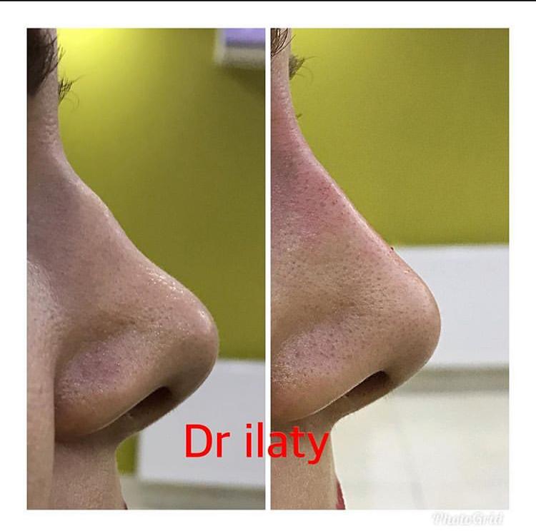 دکتر اکبر ایلاتی - gallery