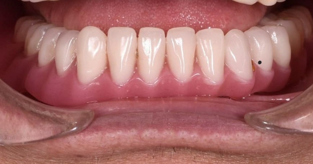 آرش غفوری - gallery