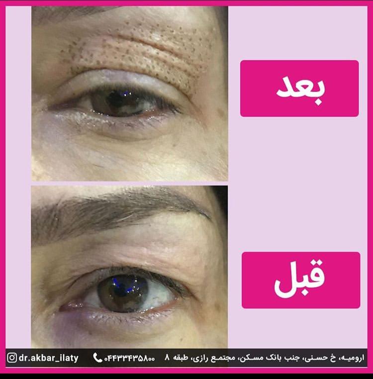 دکتر اکبر ایلاتی - gallery