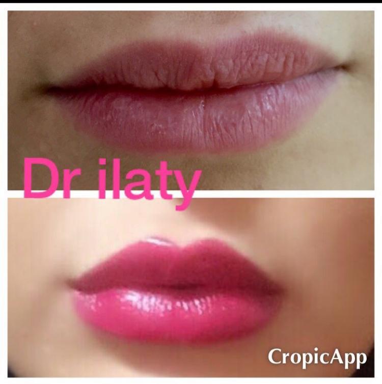 دکتر اکبر ایلاتی - gallery