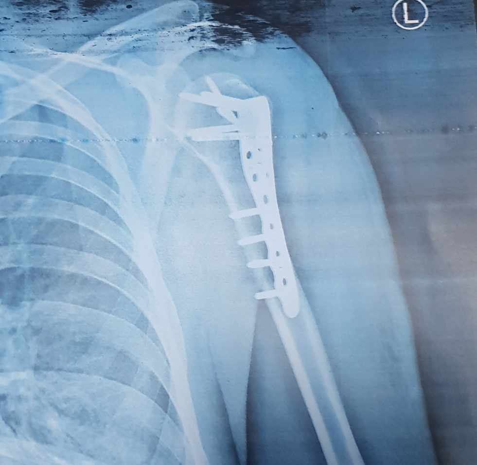 دکتر علی معظمی پور - gallery