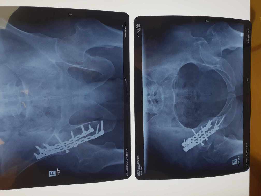 دکتر علی معظمی پور - gallery