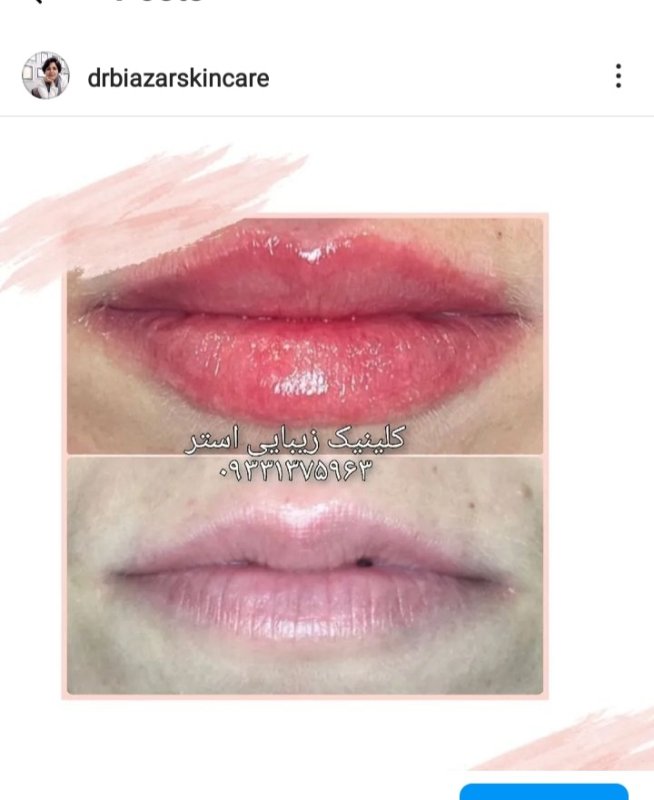 تهمینه بی آزار - gallery