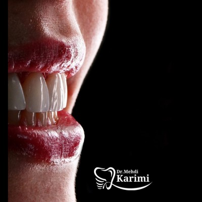 دکتر مهدی کریمی - gallery