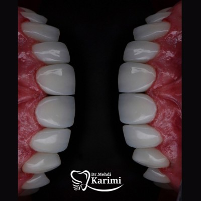 دکتر مهدی کریمی - gallery