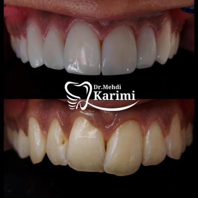 دکتر مهدی کریمی - gallery