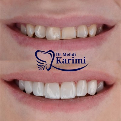 دکتر مهدی کریمی - gallery